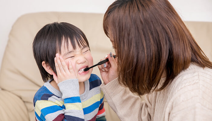 抜歯後の注意点